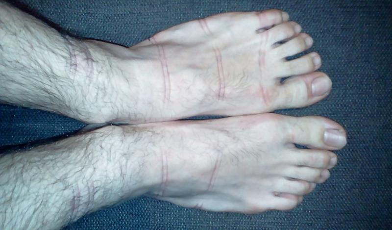 15P Bound feets