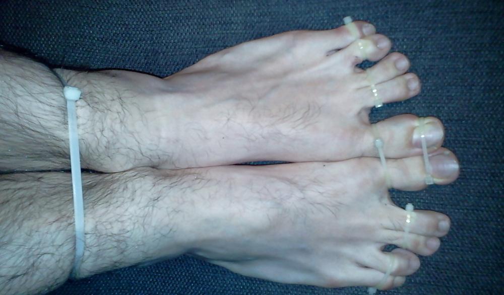 15P Bound feets