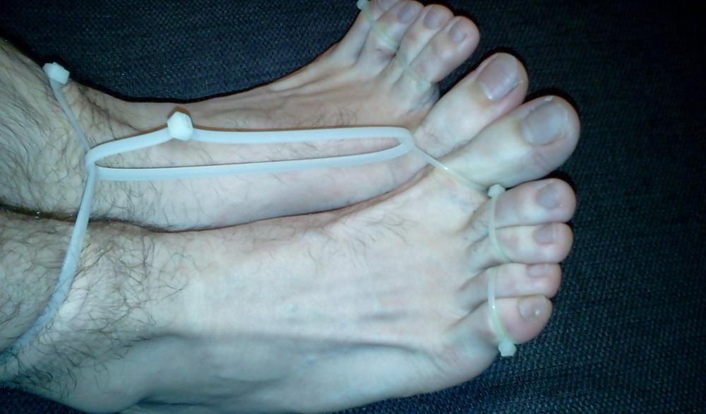 15P Bound feets