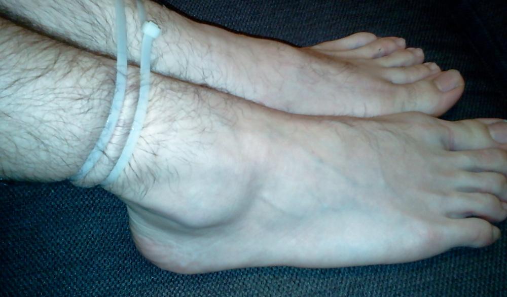 15P Bound feets