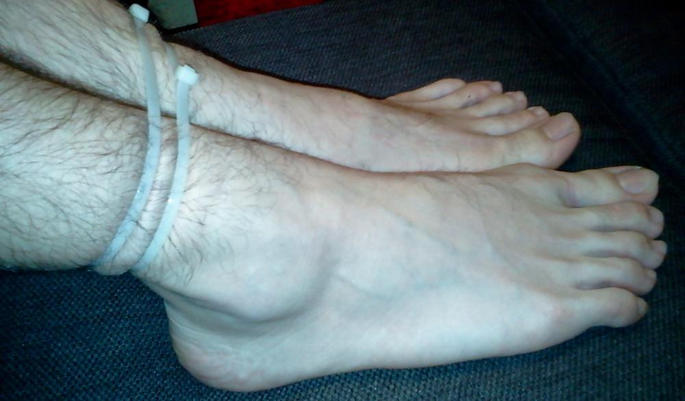 15P Bound feets