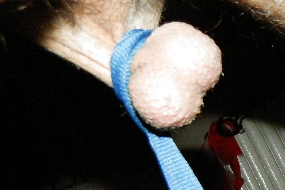 15P My stretched balls