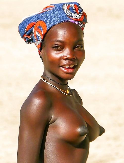 25P Puffy Nipples Areola 2