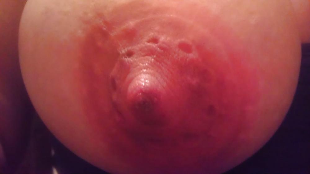 24P Huge nipples