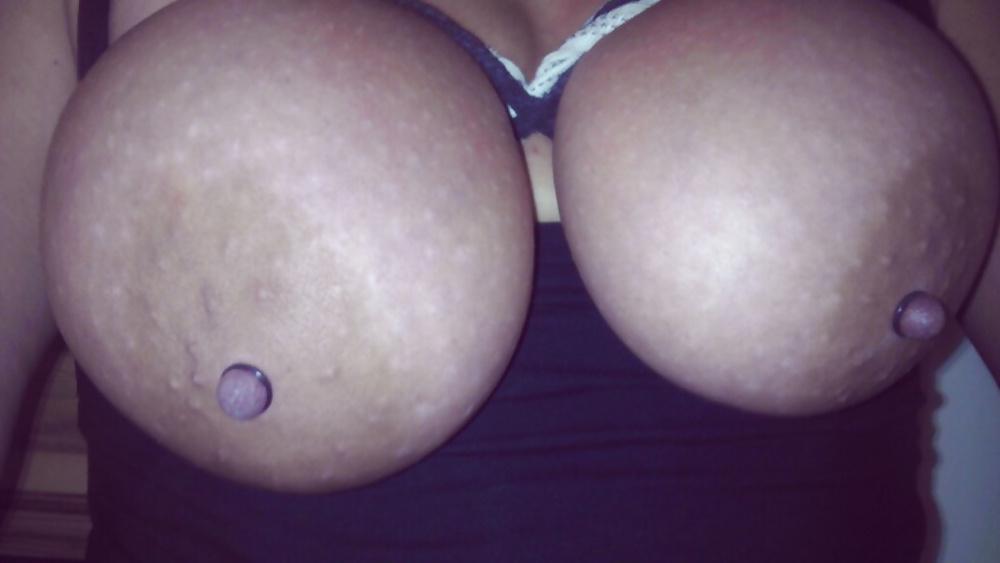 24P Huge nipples