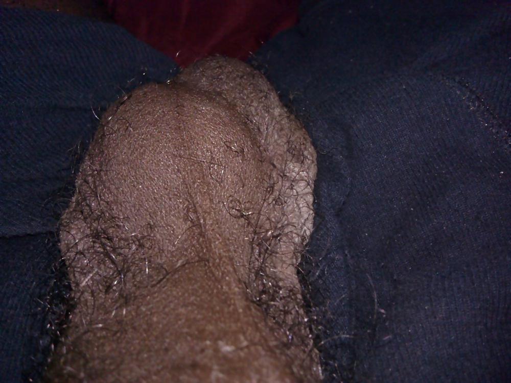 6P Hairy balls