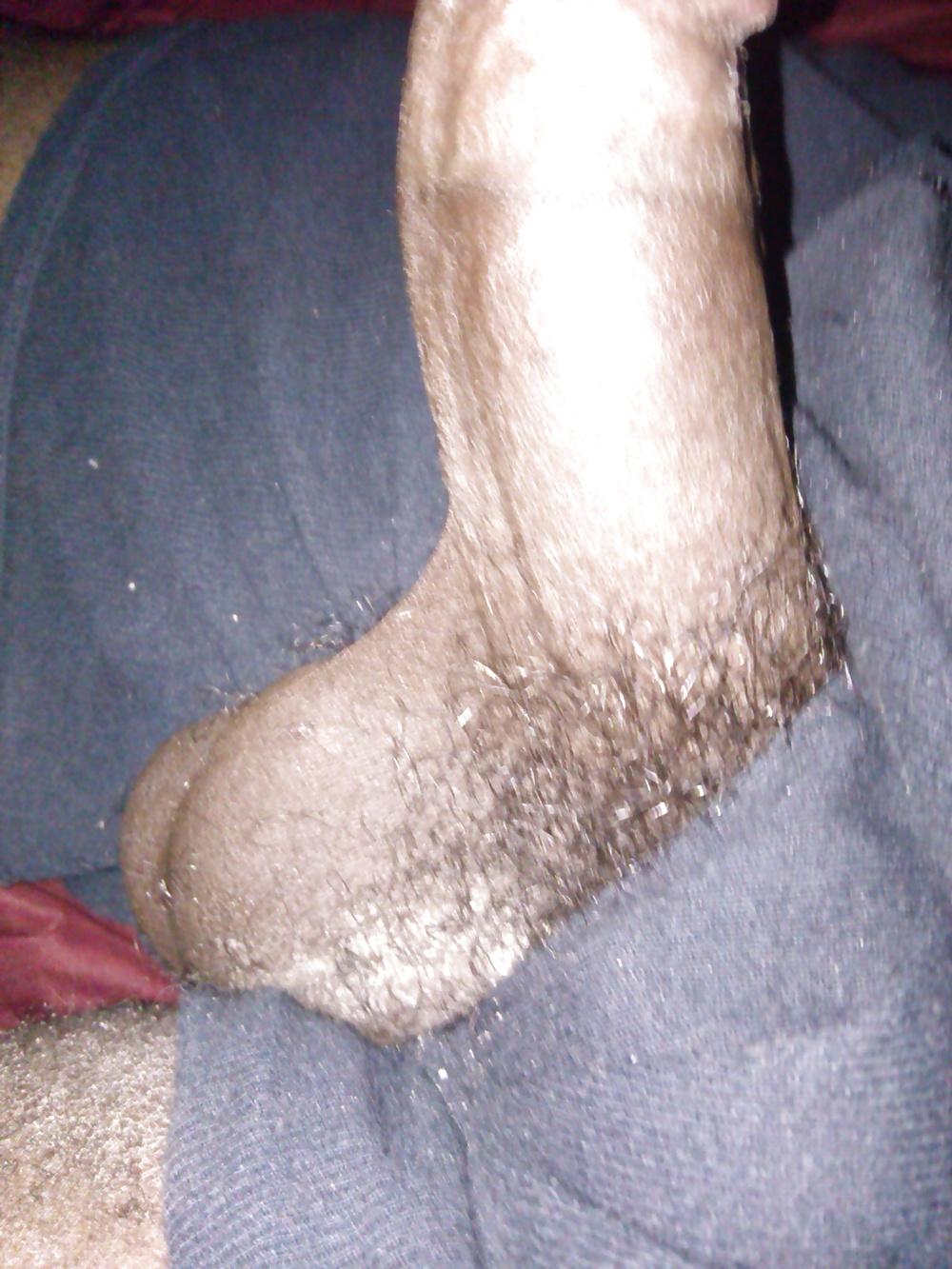 6P Hairy balls