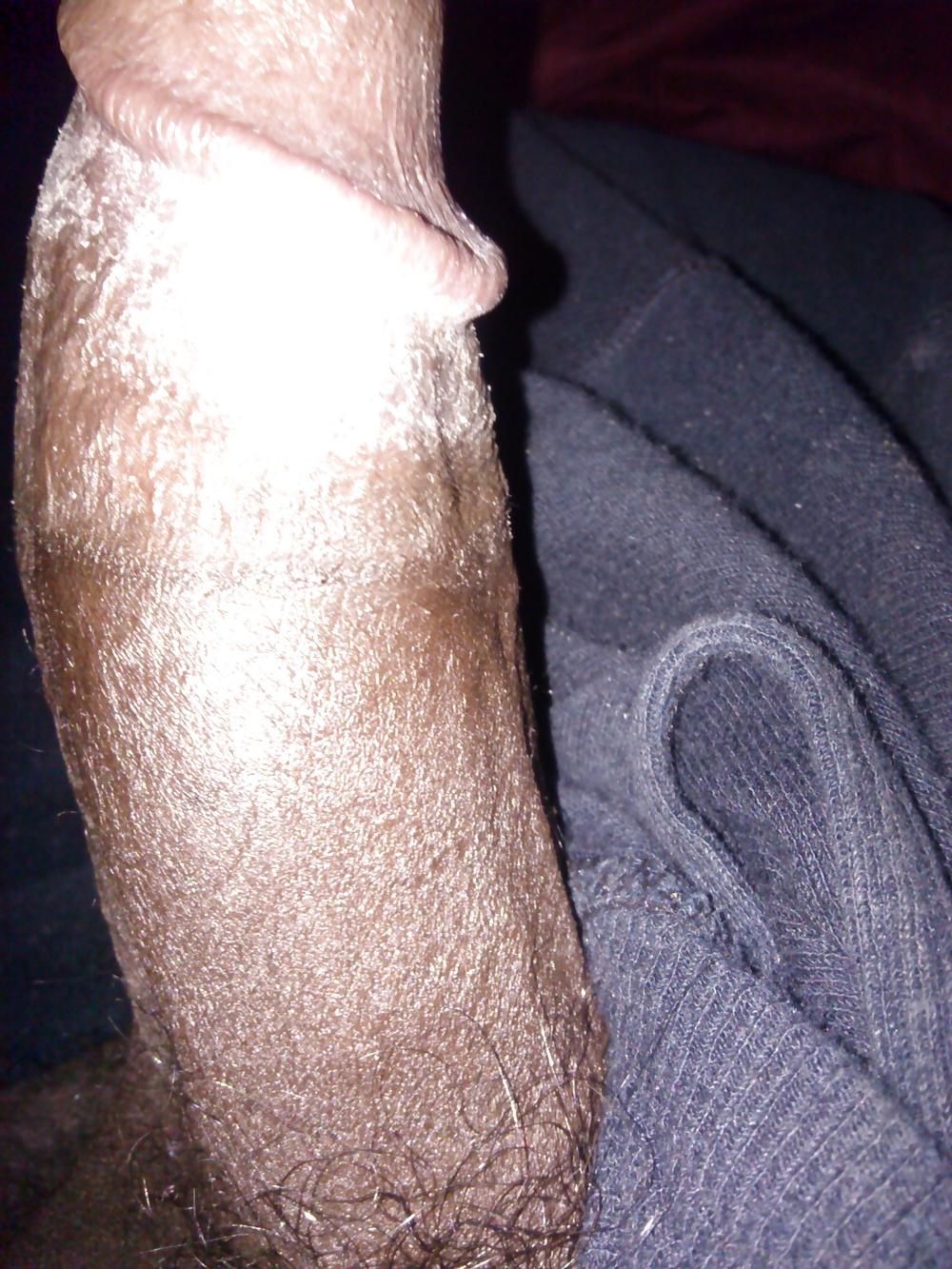 6P Hairy balls
