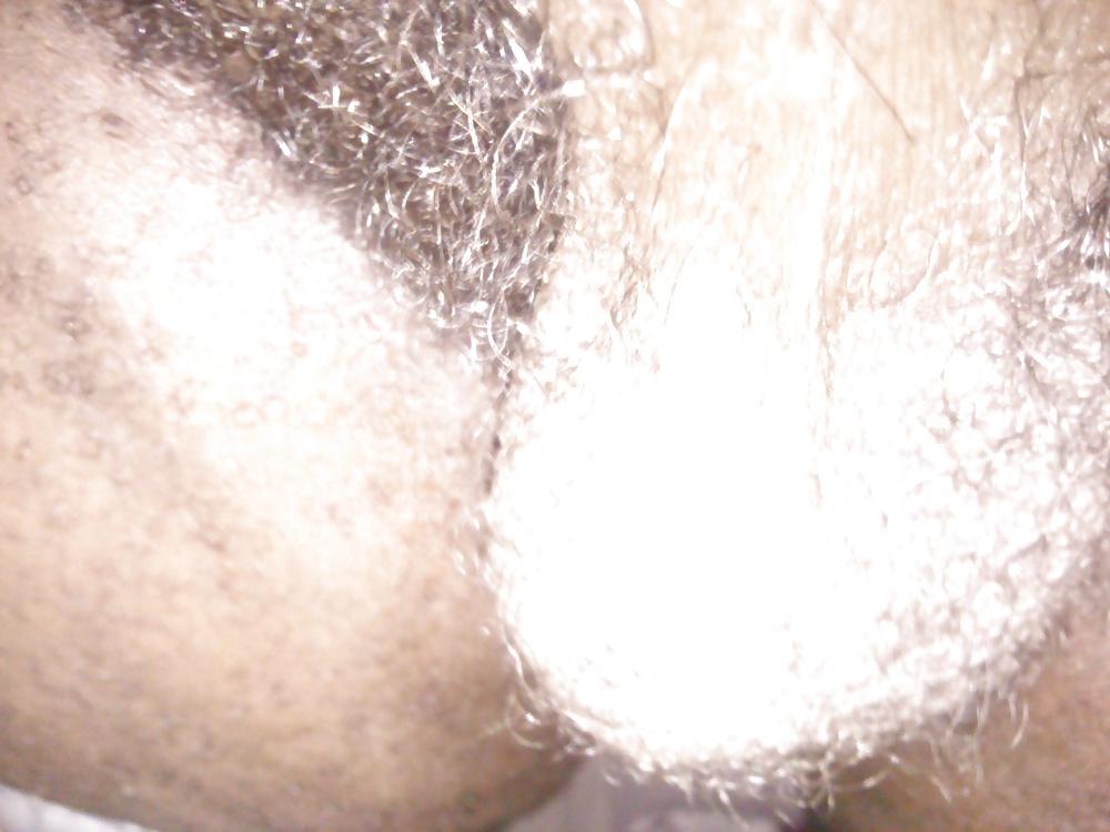 6P Hairy balls