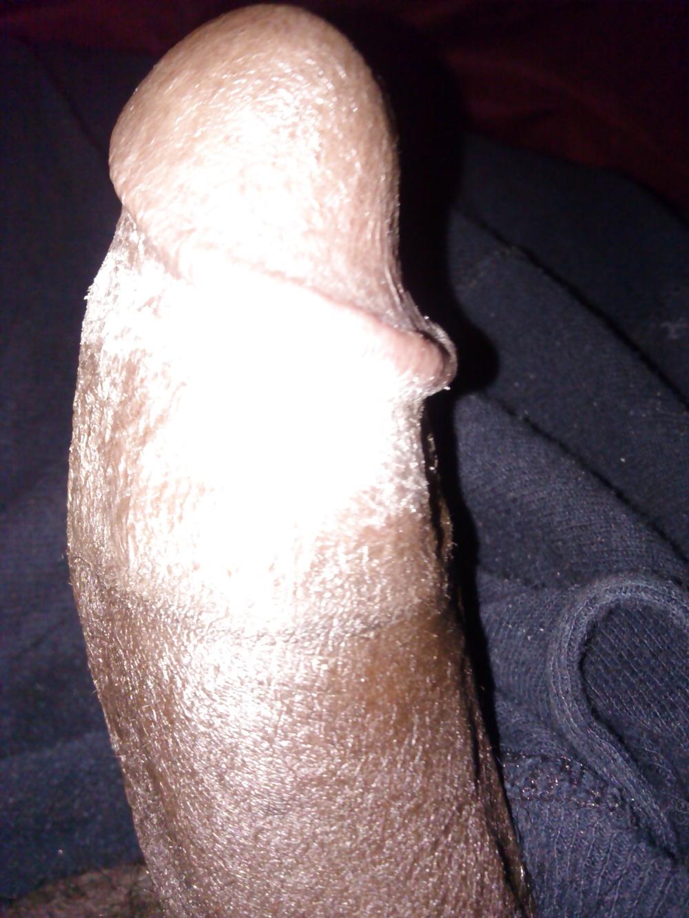 6P Hairy balls