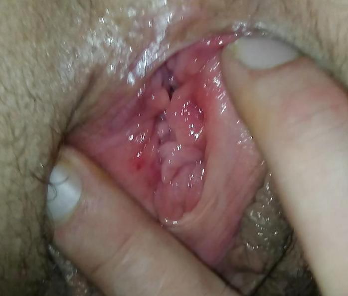 5P Extreme close ups of my wife gaping and cumming