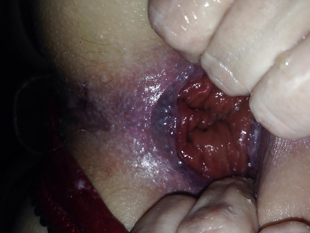 4P Anal fisting