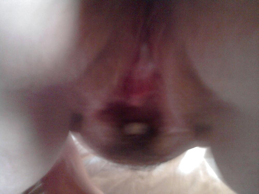15P Creampie Anna pussy(amateur)