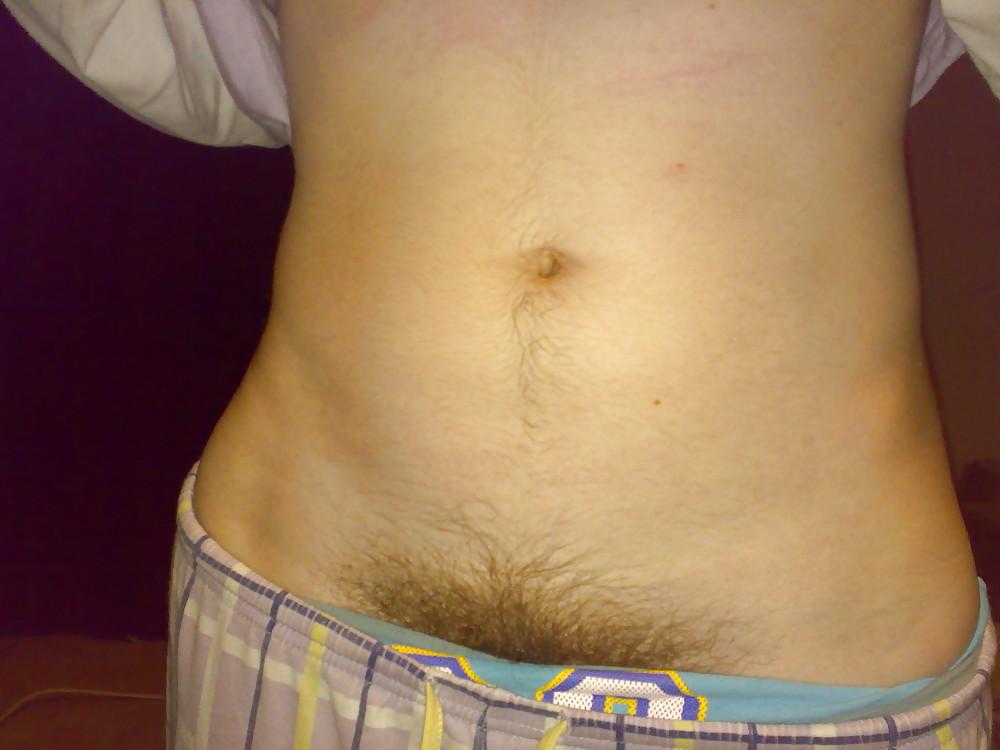 14P Hairy hot to the extreme
