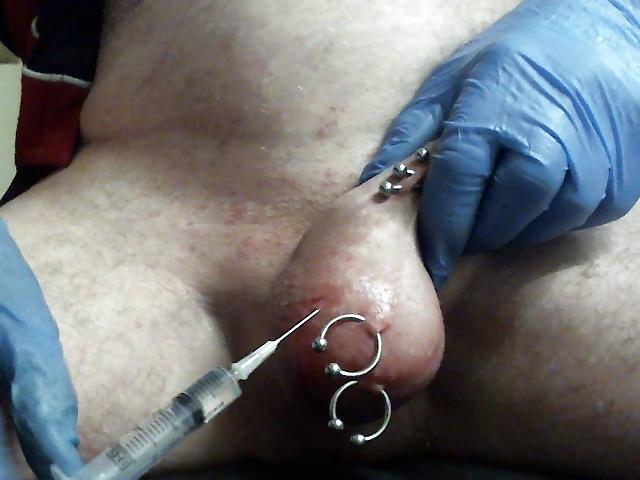 6P Saline Balls