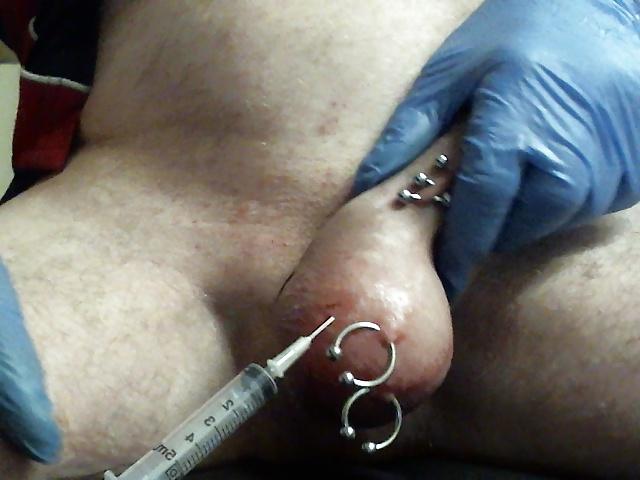 6P Saline Balls