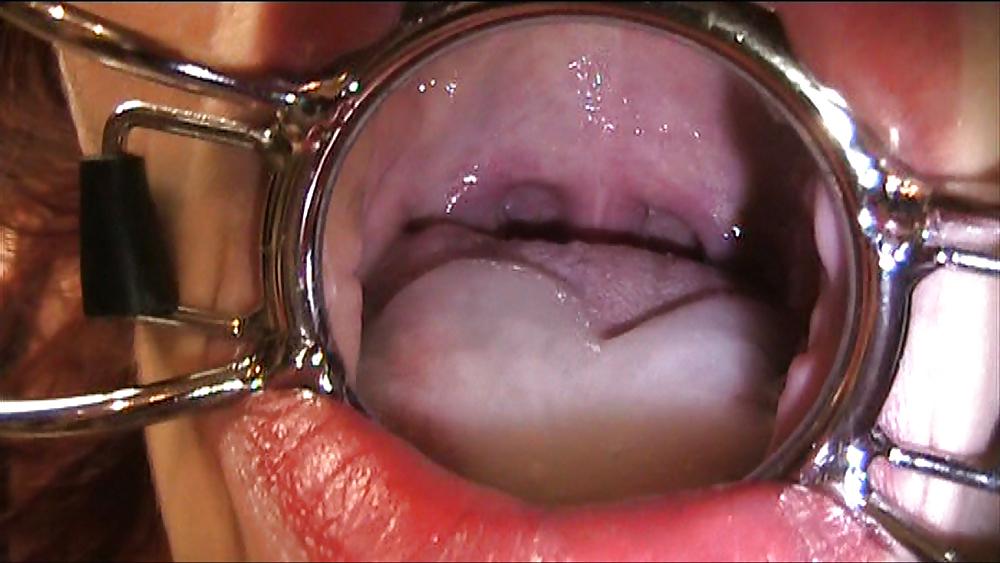 25P Cum filled mouth