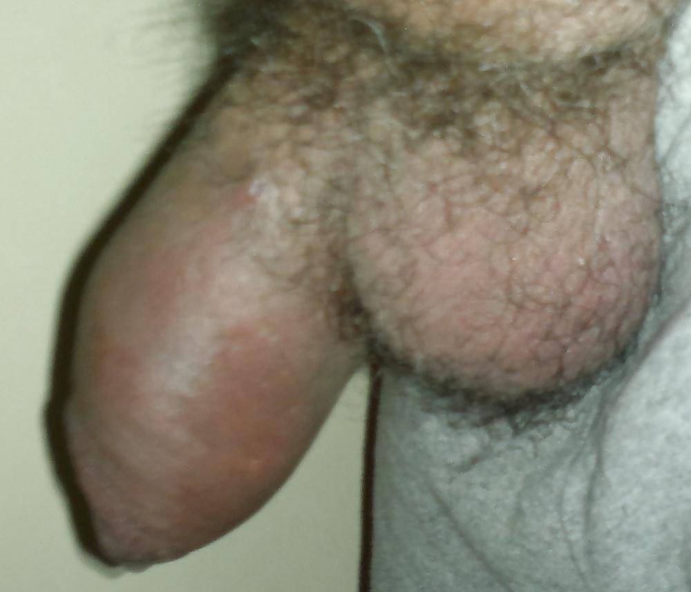 11P THE PENIS INSIDE MY BOTTLE