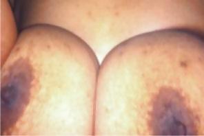10P Anonymous Big Tits