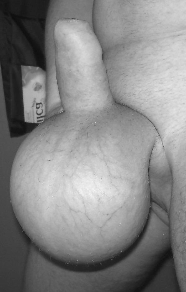 11P My own Saline Balls