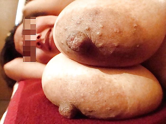 15P Areolas And Nipples: Big And Thick#14