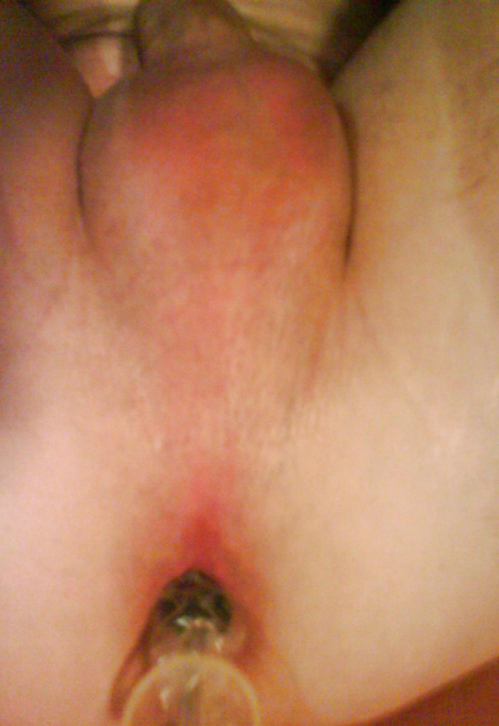 5P Tool Insertion