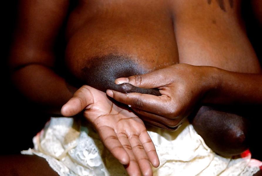 16P Lactating nipples