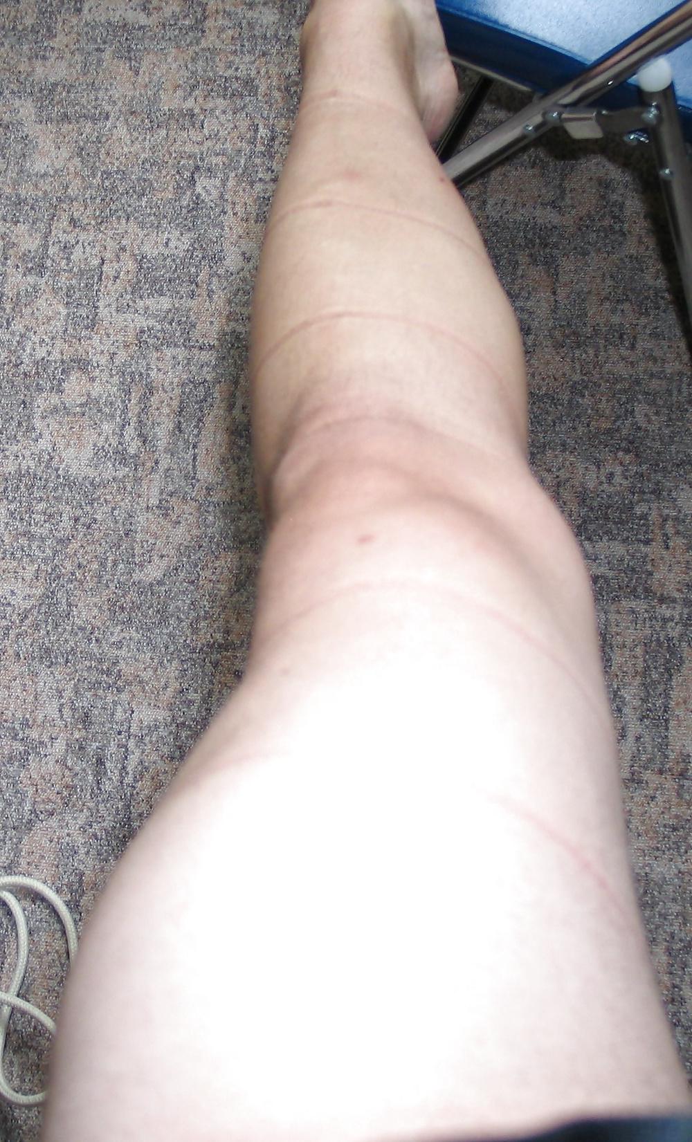 23P My Legs with Nylon and without Nylon, bound and not bound.