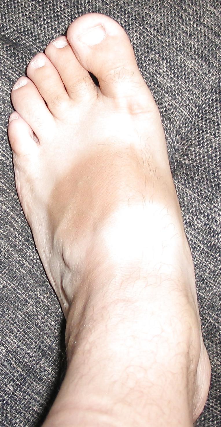 23P My Legs with Nylon and without Nylon, bound and not bound.