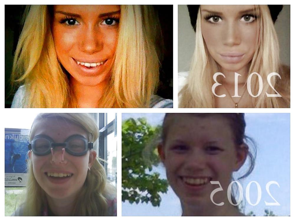 25P A swedish girl called Nicole S.