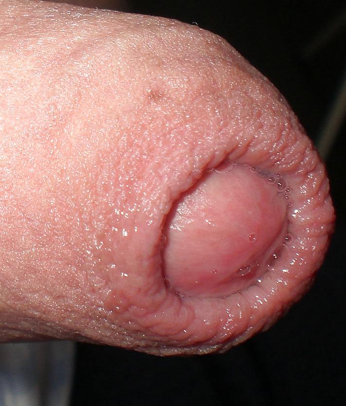 8P Mein alter irischer Schwanz