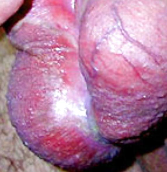 7P RED BALLS