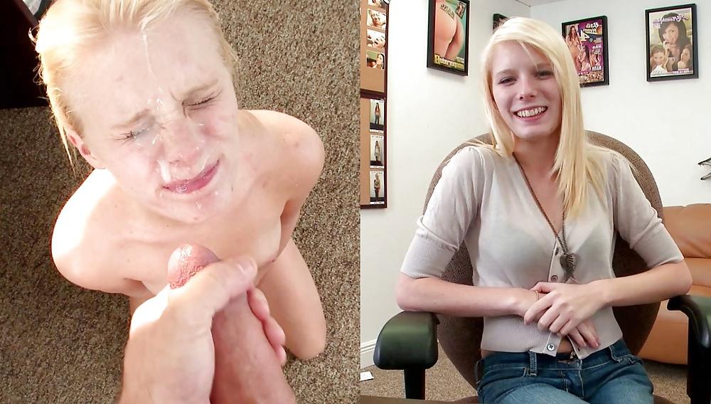 25P Before-After Facials