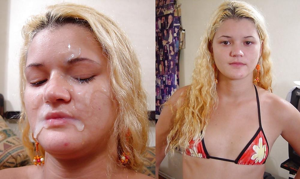 25P Before-After Facials