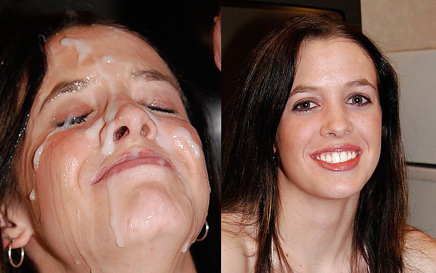 25P Before-After Facials
