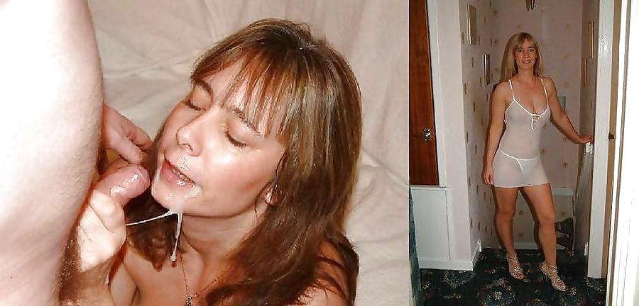 25P Before-After Facials