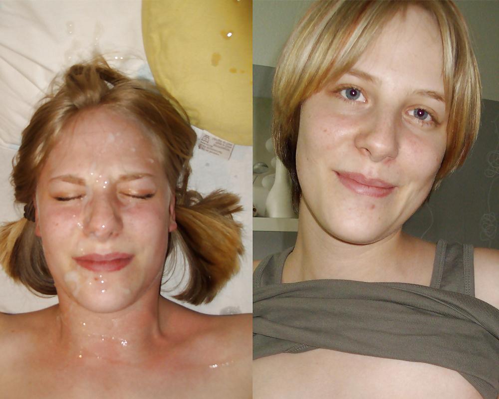 25P Before-After Facials