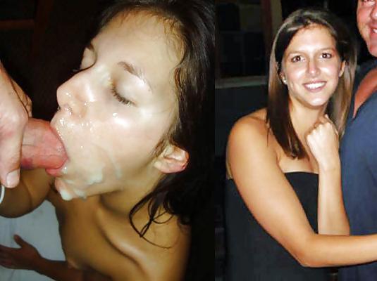25P Before-After Facials