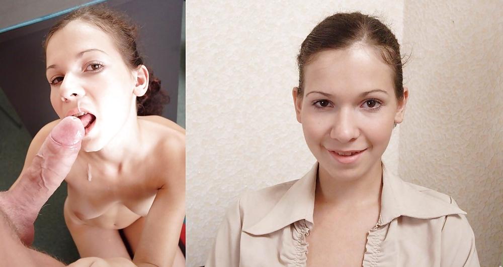 25P Before-After Facials