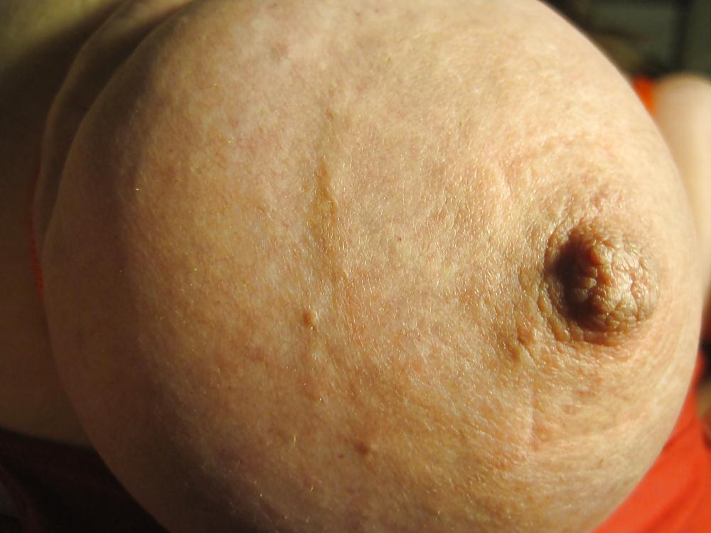 20P Bound breasts