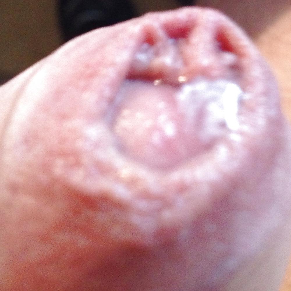 10P Pre-cum