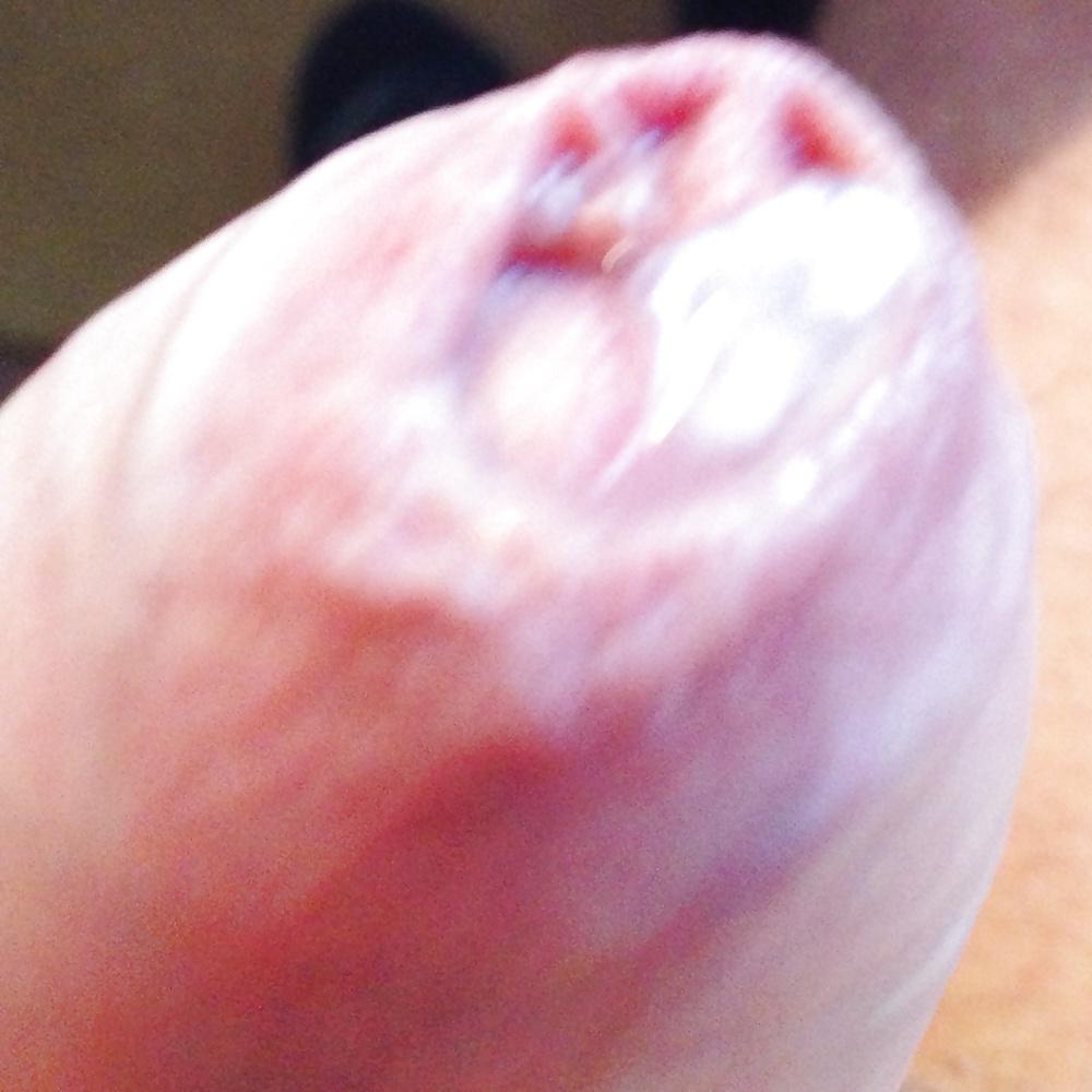 10P Pre-cum