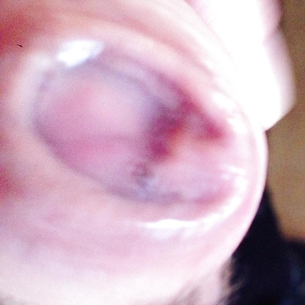 10P Pre-cum