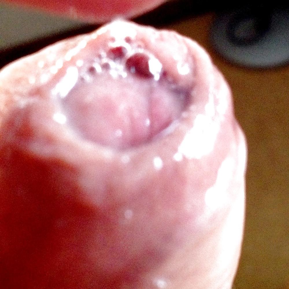 10P Pre-cum