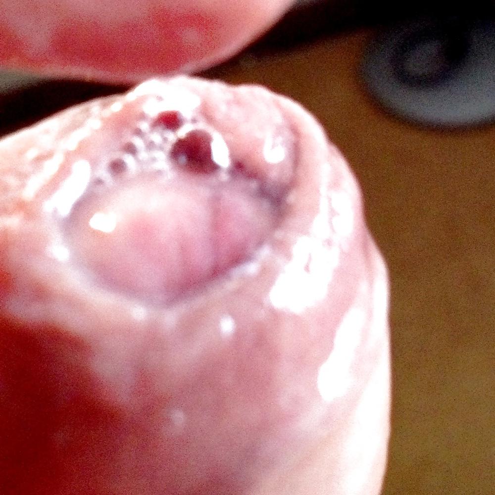 10P Pre-cum