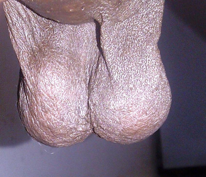 25P Hanging balls