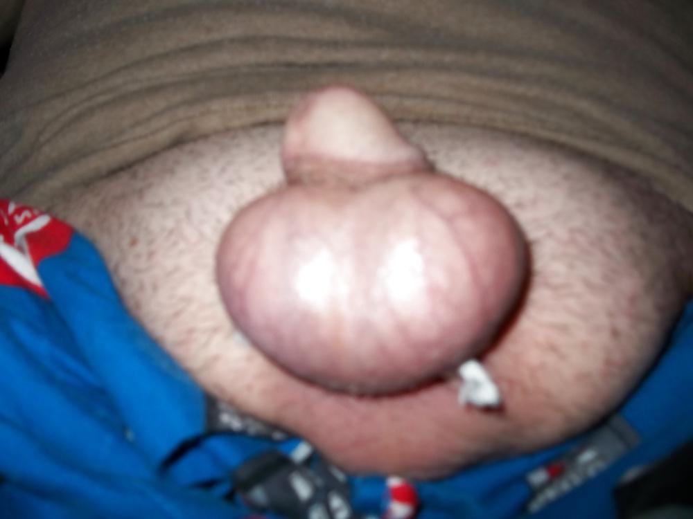 20P Playing with my balls