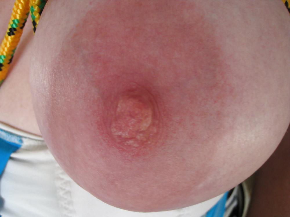 14P Areolas and Saggy Tits of my GF