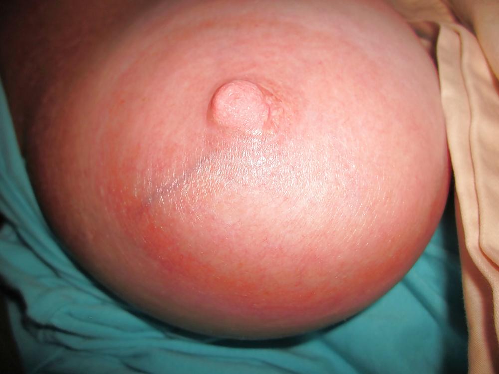 14P Areolas and Saggy Tits of my GF