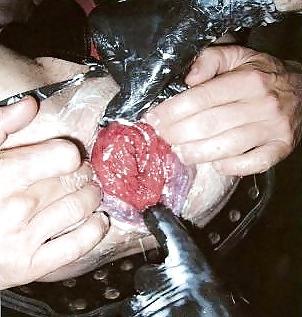20P Extreme mancunt